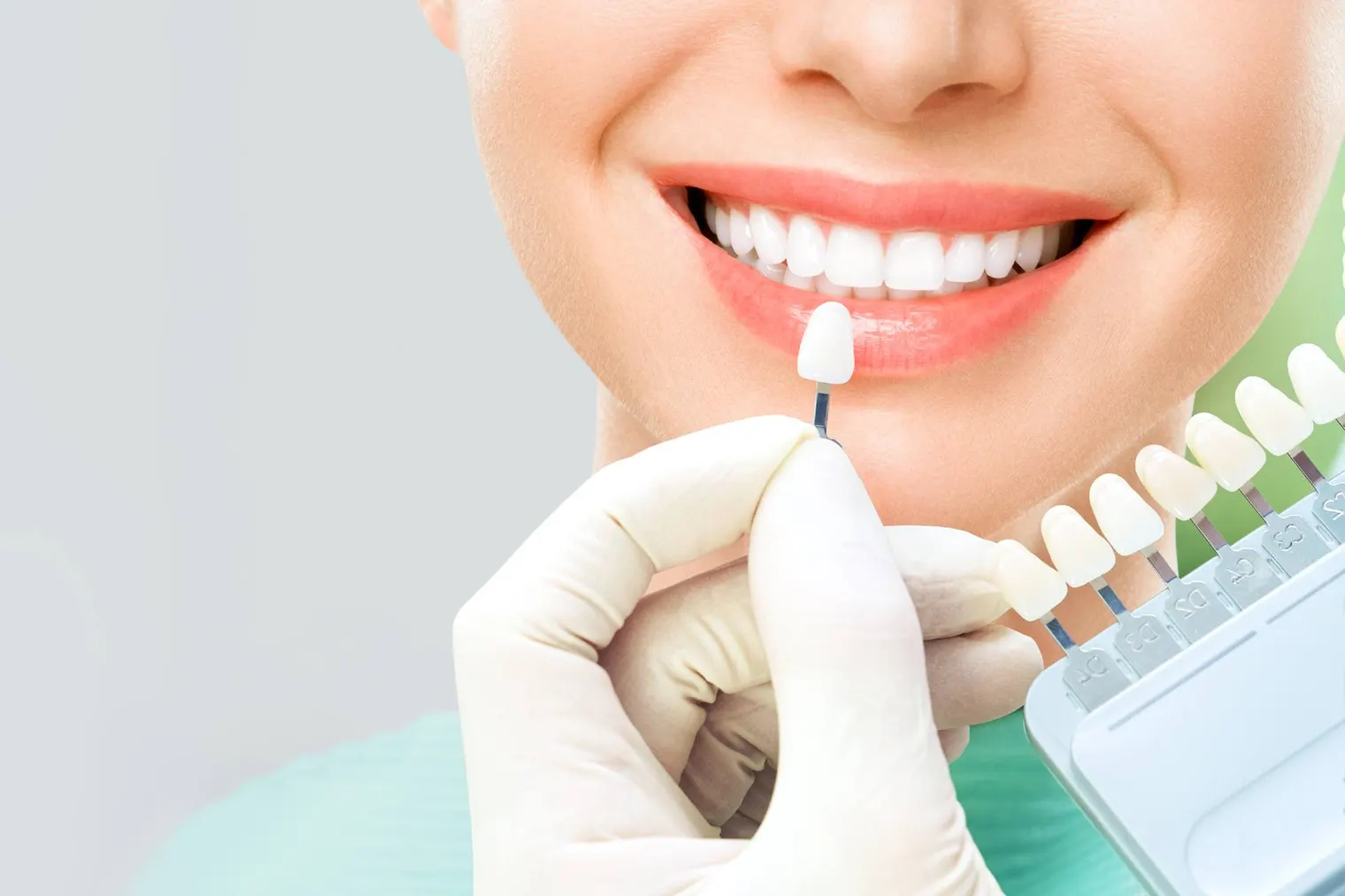 10 Things to Know Before Getting Porcelain Veneers