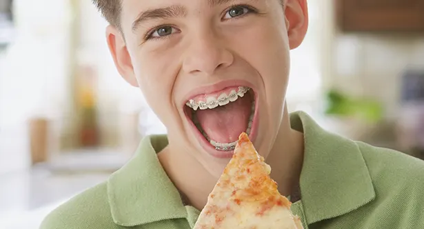 5 foods you should never eat with regular braces