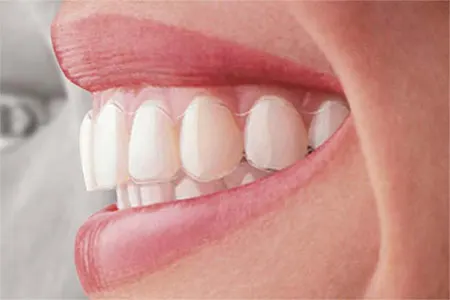 tooth clinic near me