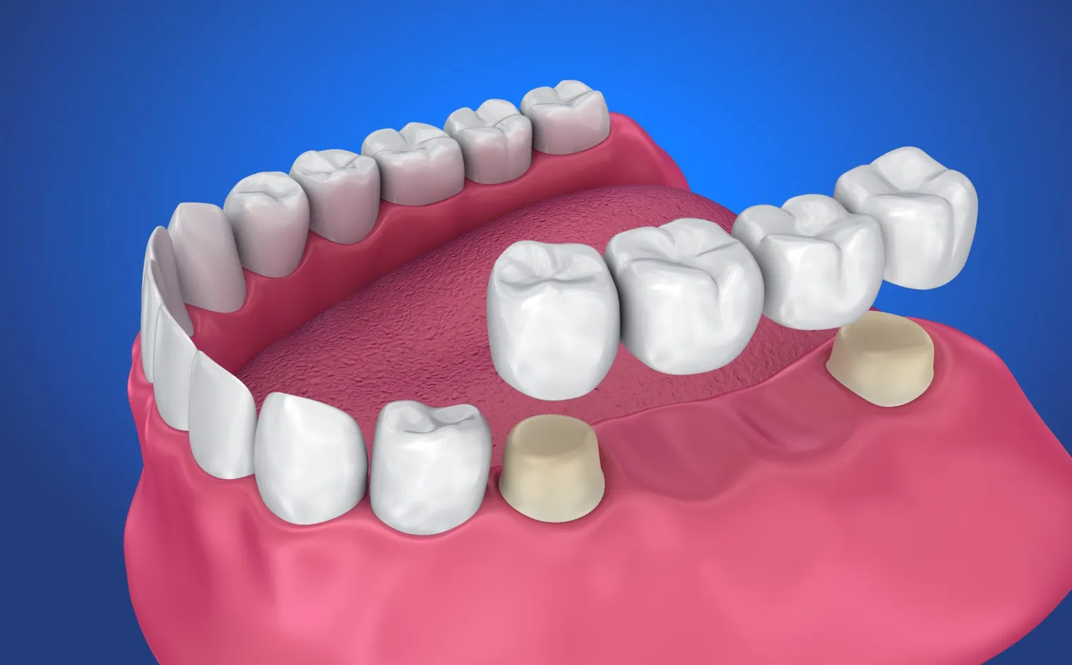 Expert Oral Health Care Services