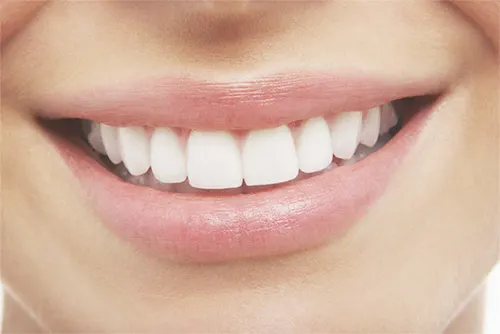 zoom whitening dubai