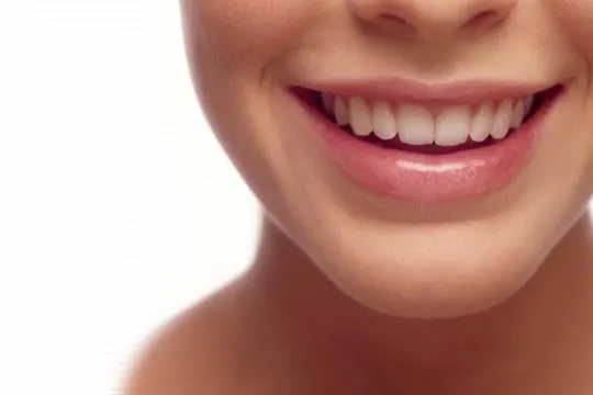 Inlays and Onlays Dental Filling in Dubai