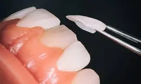 Dental Clinic in Sharjah