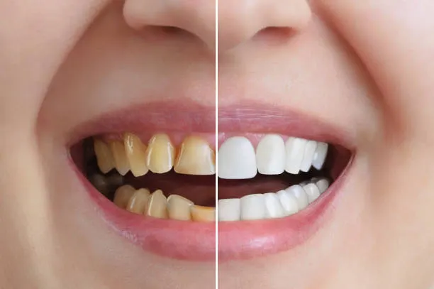 american dental clinic dubai