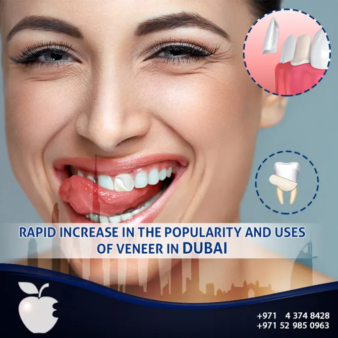 dental clinic in dubai