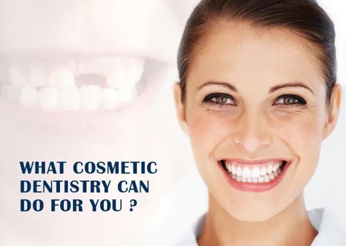 veneers in dubai