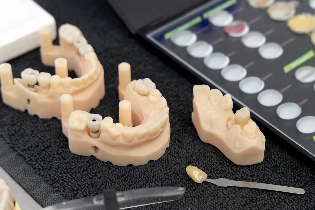 Dental implant models and shade guide at American Medical & Dental Center