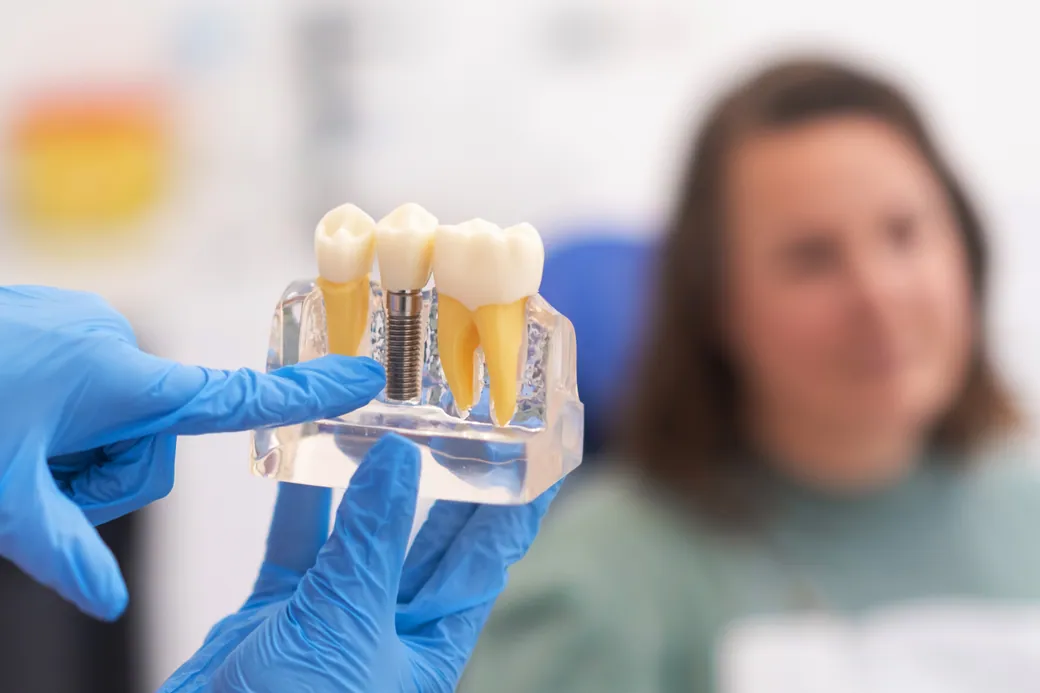 Dental implant model beside natural teeth