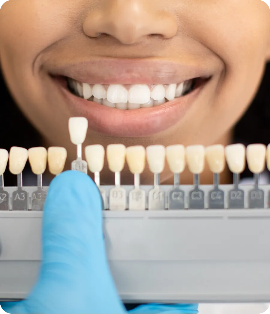 Dental crown being fitted