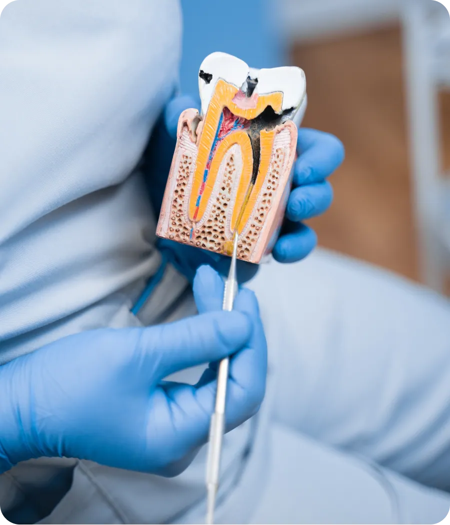 Dentist explaining treatment on a tooth model