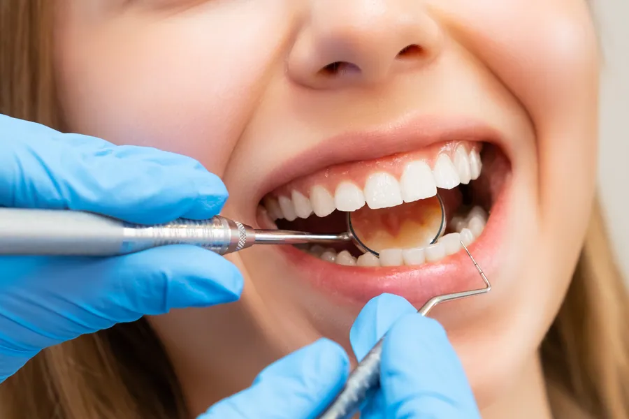 Periodontal deep cleaning in progress