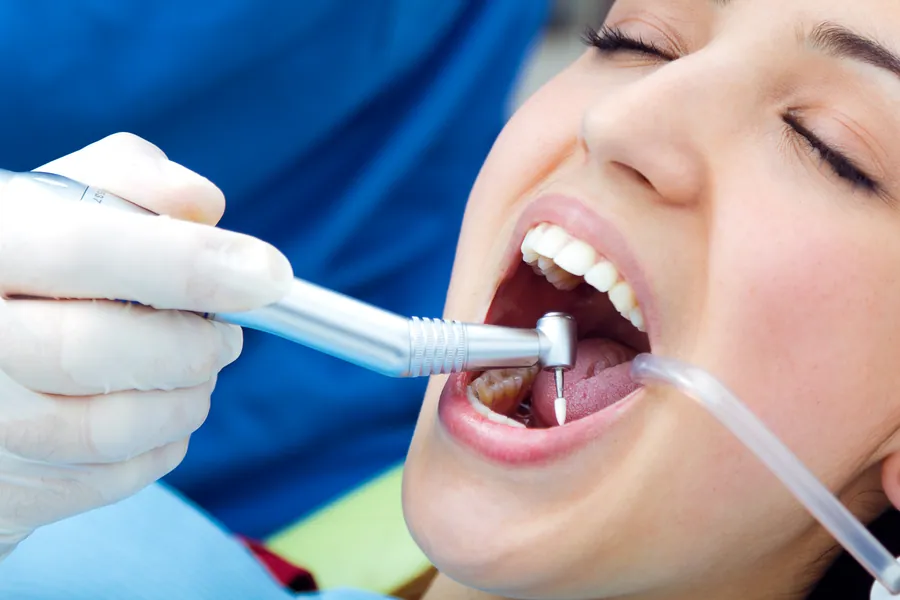Composite resin being shaped on a tooth