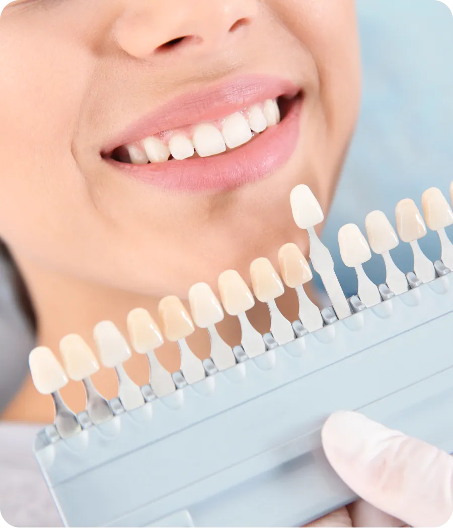 Dentist matching veneer shades to a patient's teeth