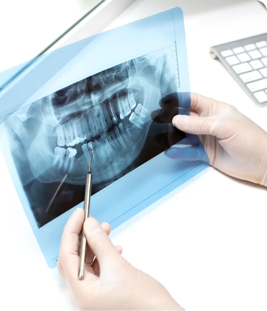 Patient smiling after a dental implant