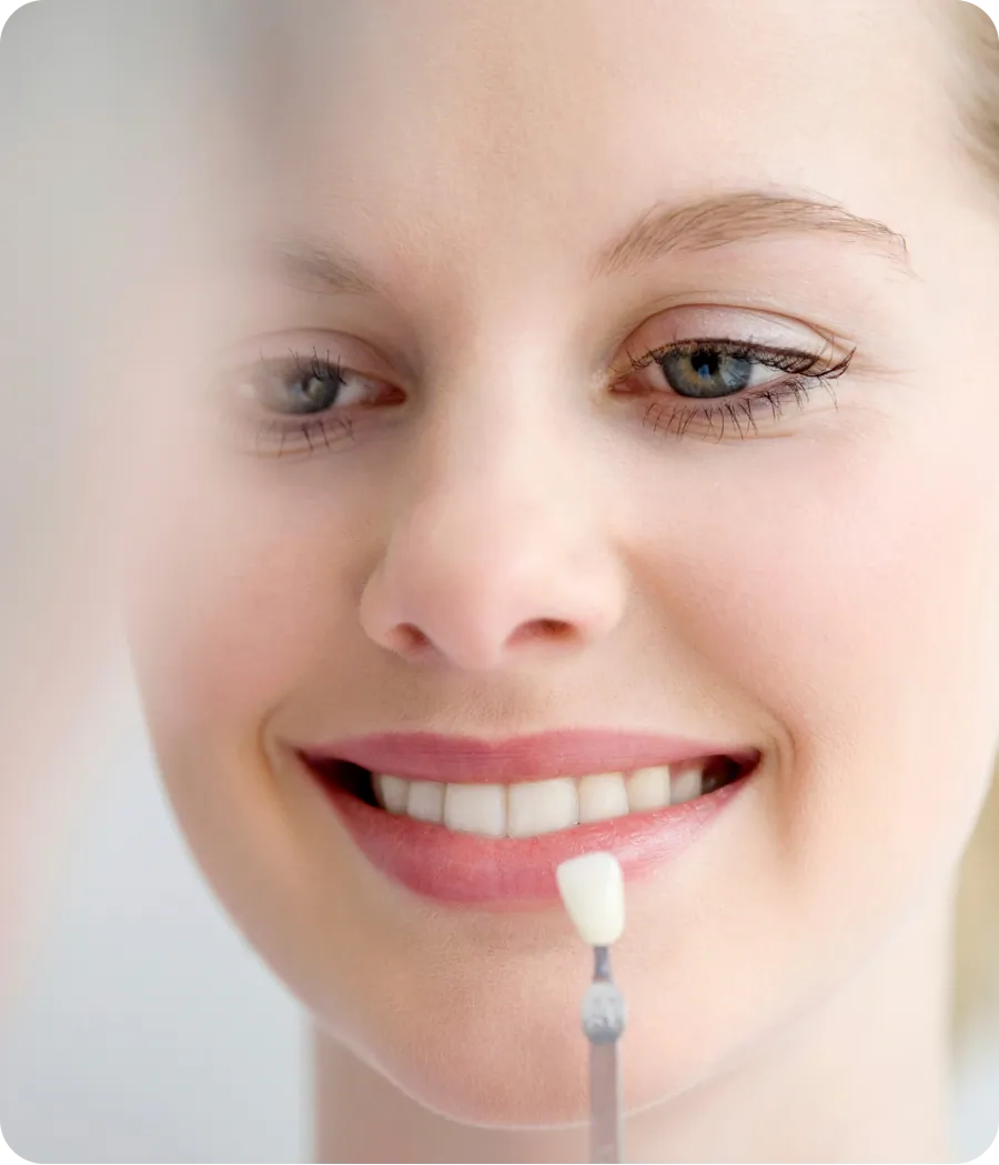 Patient smiling after porcelain veneers