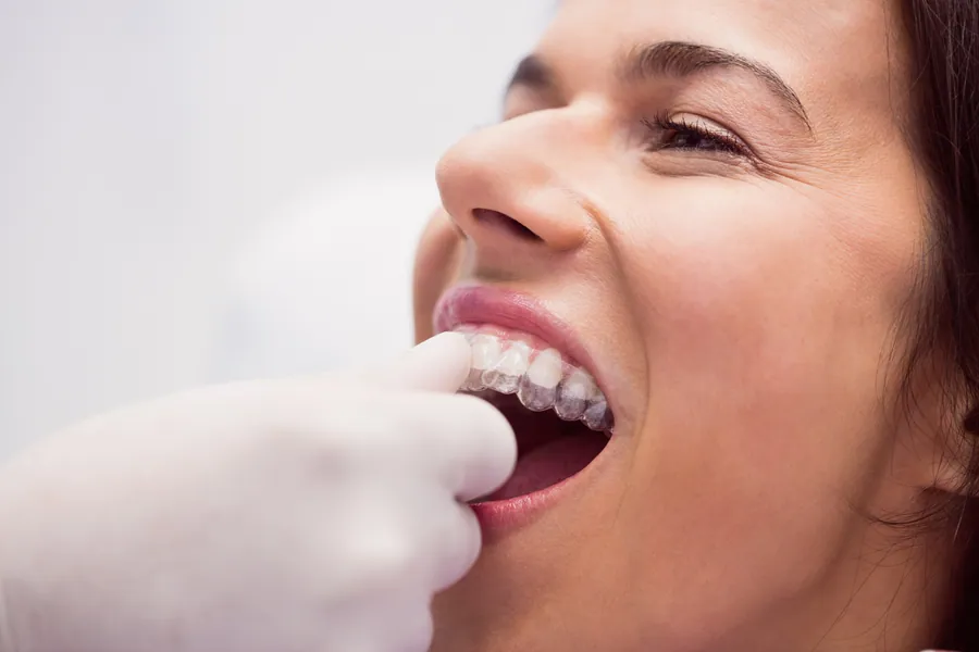 Patient holding a clear aligner