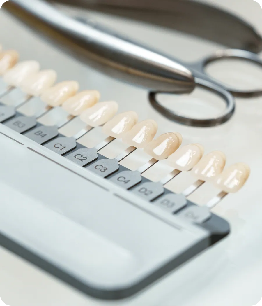 Porcelain veneers at AMDC