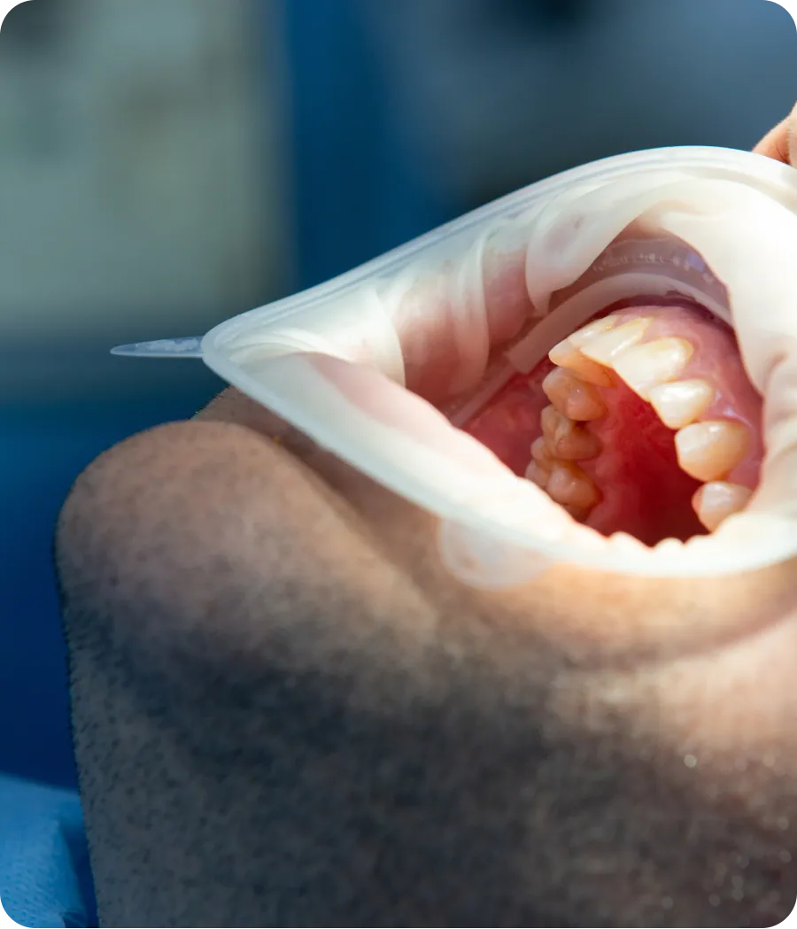 Periodontist examining receding gums
