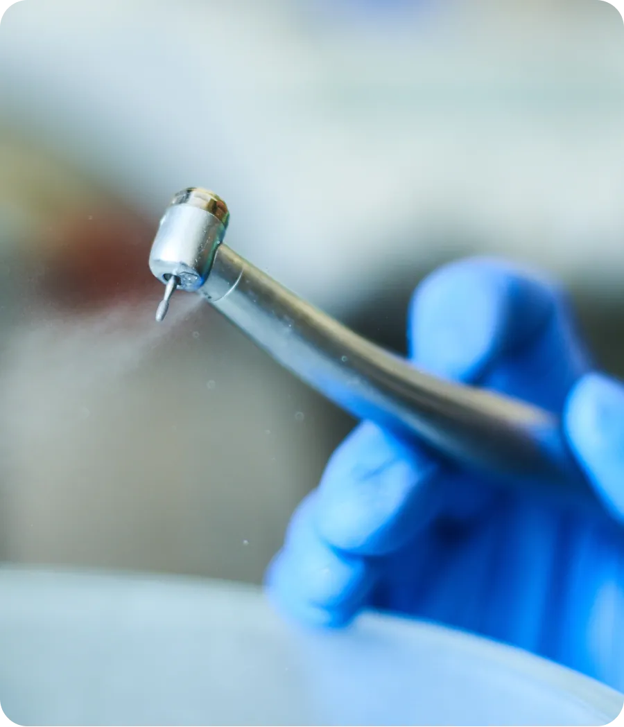 Illustration of a tooth's root canals